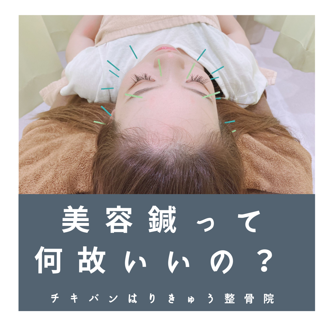 美容鍼ってどうしていいの！？【完全保存版】