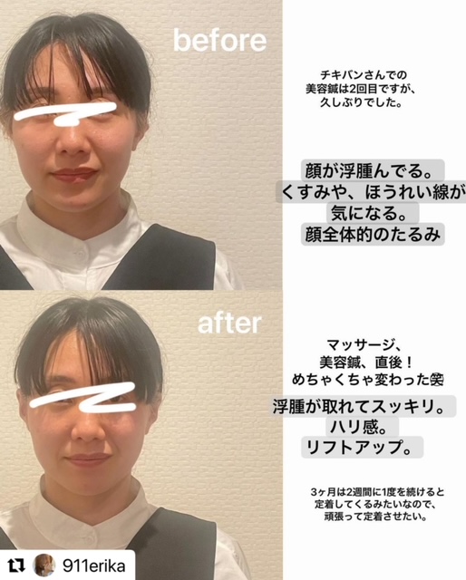 アパレル業界で活躍のエリカ様がご来院くださいました★