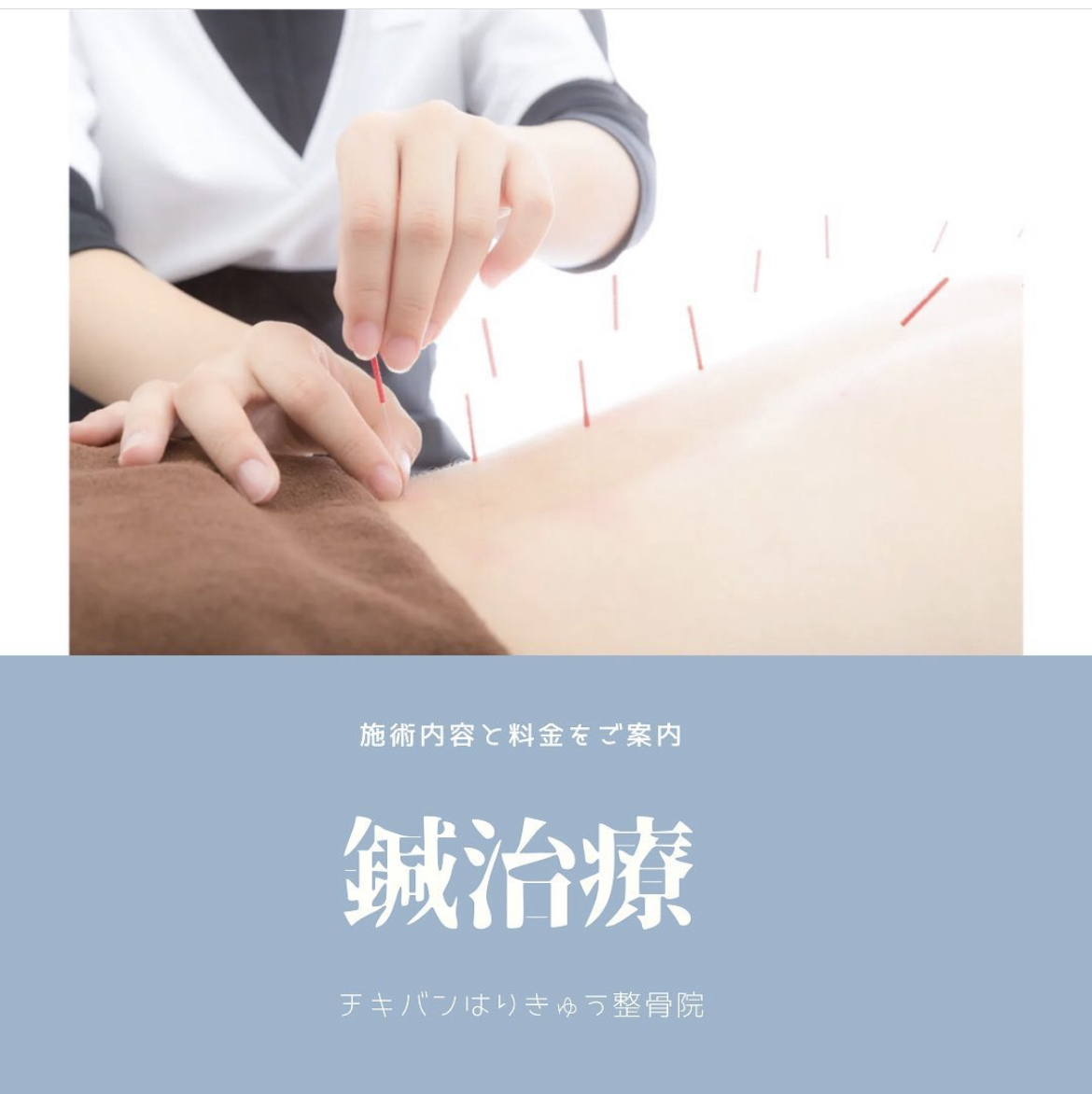 チキバンの体の鍼治療★
