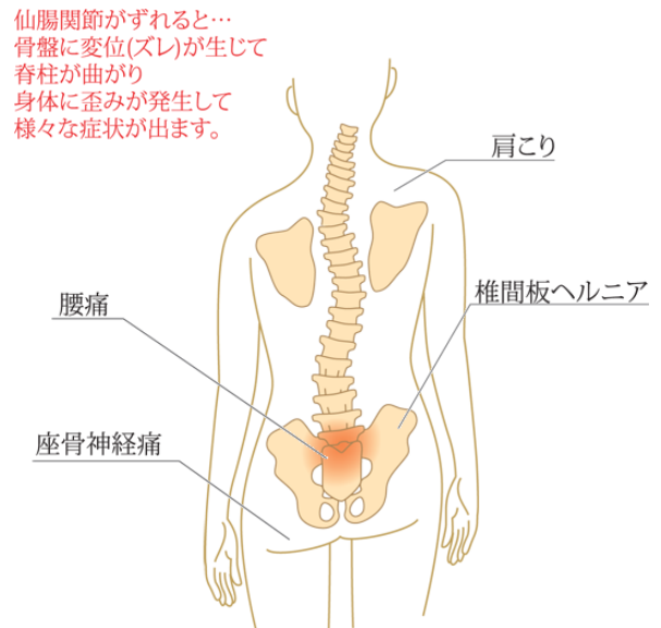 骨盤矯正で骨盤の歪みからおさらば！ダイエット効果にも◎