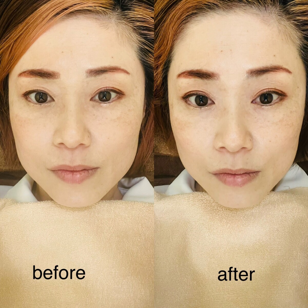 むくみは早急な対処が必要です！