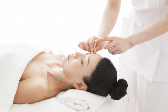 美容鍼灸とは？