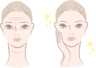 なぜ鍼でリフトアップするの？