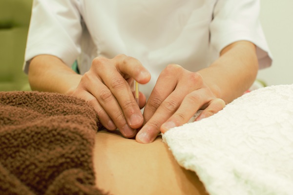 チキバンでは、鍼灸も取り扱っております！