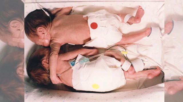 ベビーマッサージの効果♡２