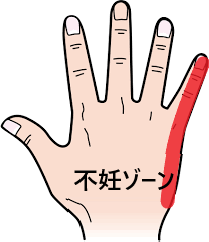 ツボ44：不妊症