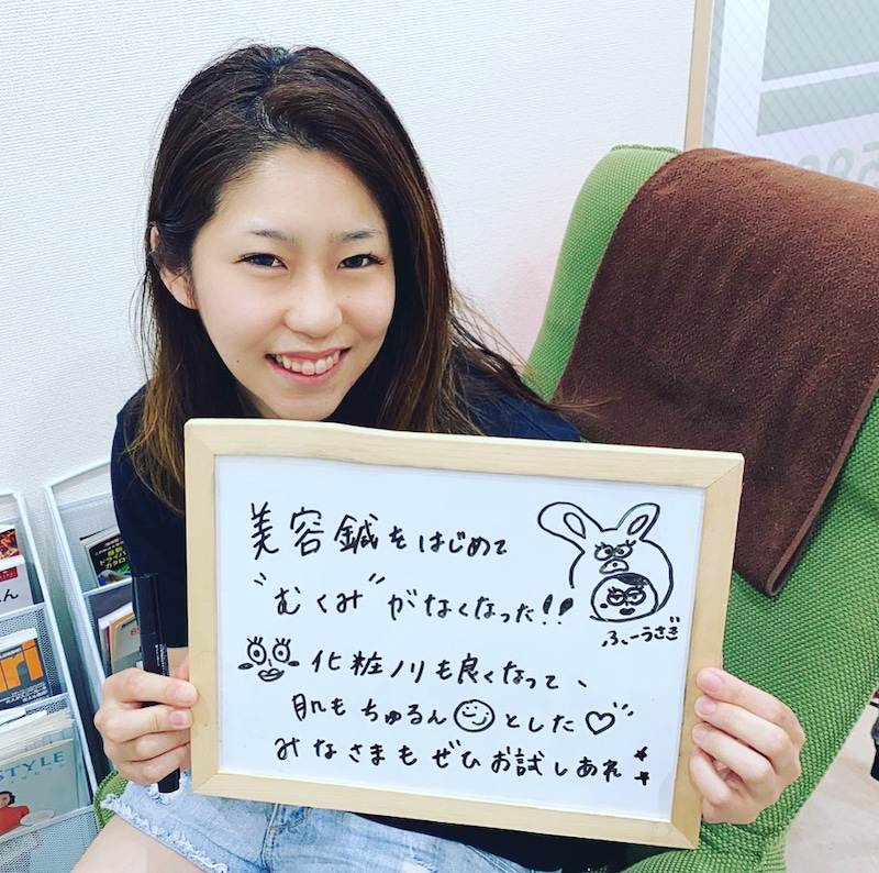 美容鍼でむくみスッキリ★