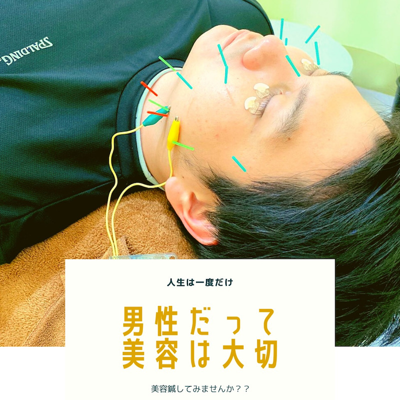 男性にも人気！美容鍼！