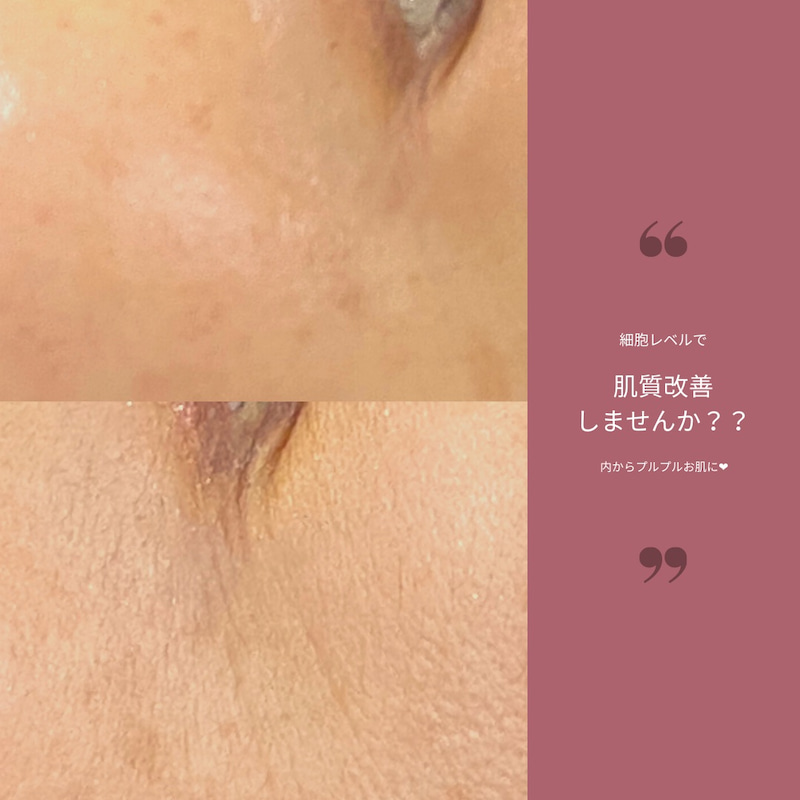 美容液だけでは老化は防げない！