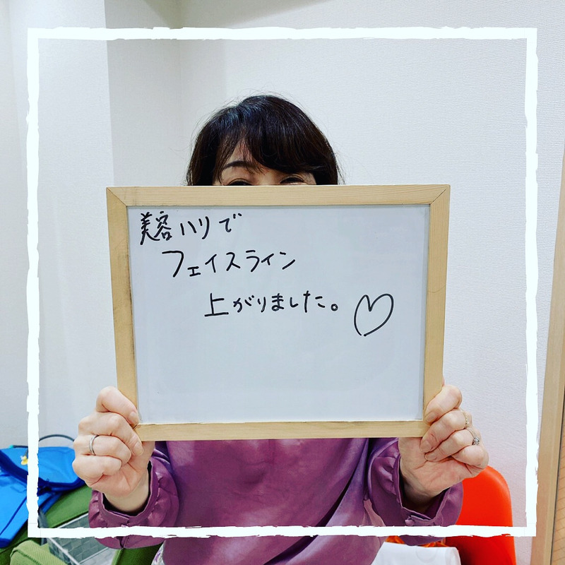 口コミ★美容鍼