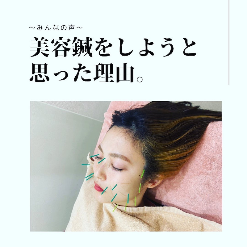 美容鍼をしようと思った理由
